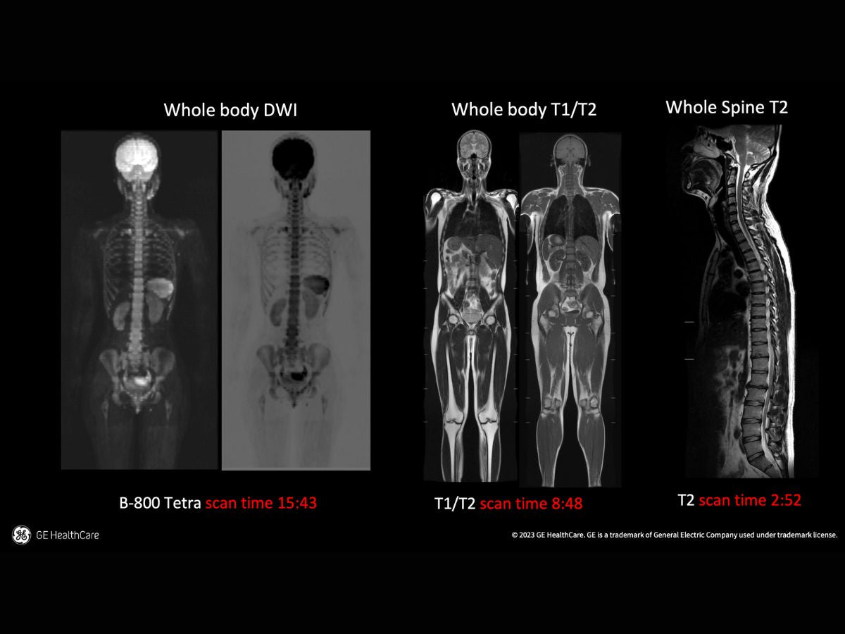 Whole Body MRI