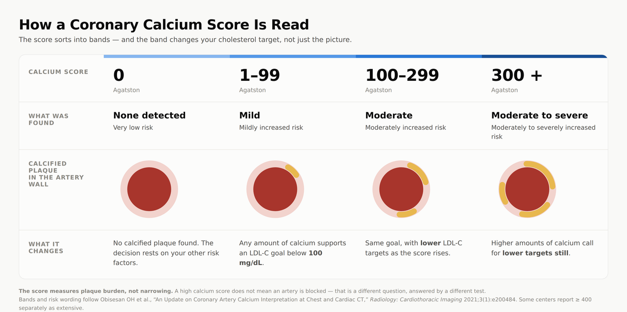 Why Americans Are Booking a Coronary Calcium Scan in Korea