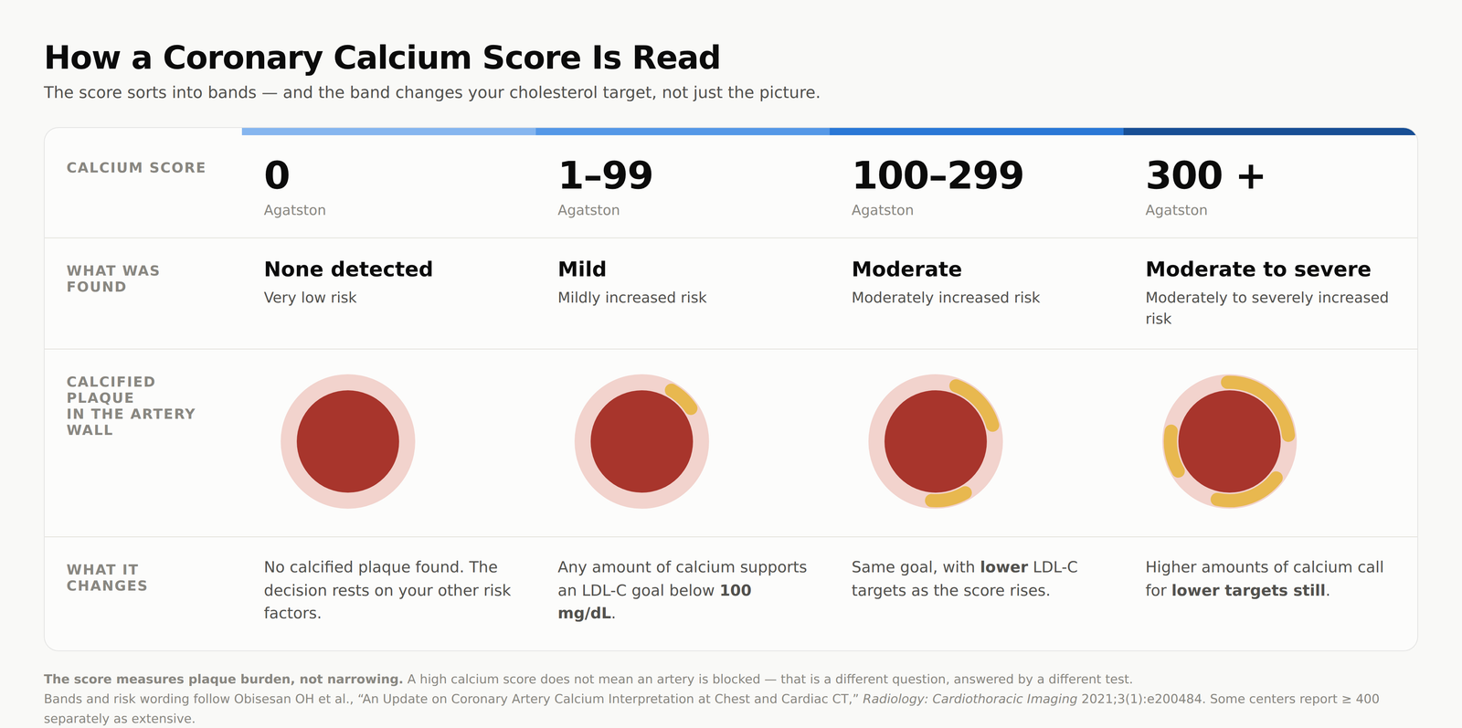 Why Americans Are Booking a Coronary Calcium Scan in Korea